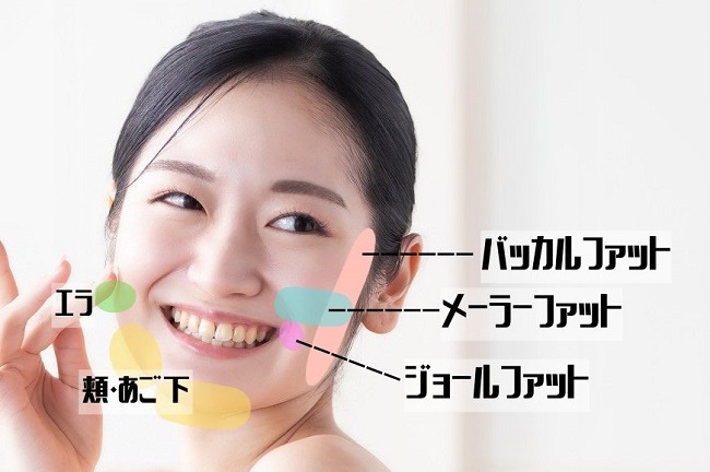 脂肪除去(バッカルファット、メーラーファット、ジョールファット)について