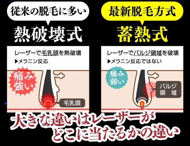 リアラクリニック新宿院(メンズ)医療脱毛イメージ