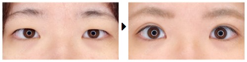 A CLINICの症例写真1