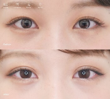 東京イセアクリニックの症例写真1