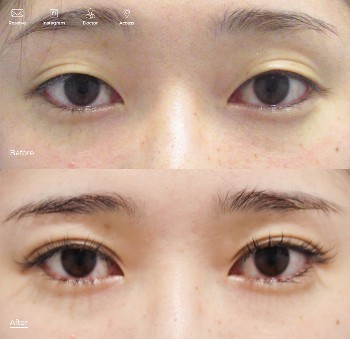 東京イセアクリニックの症例写真2