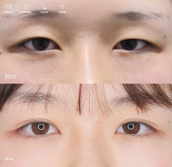 東京イセアクリニックの症例写真3