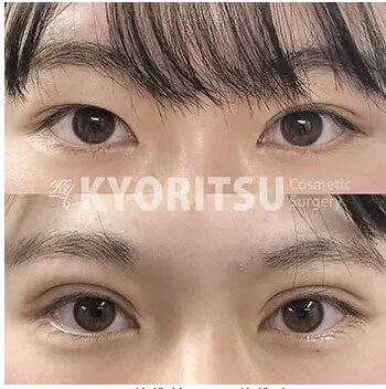 共立美容外科新宿本院の症例画像1