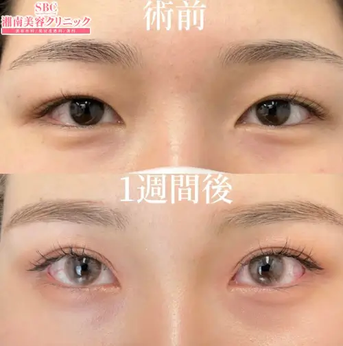 湘南美容クリニック新宿の症例写真1