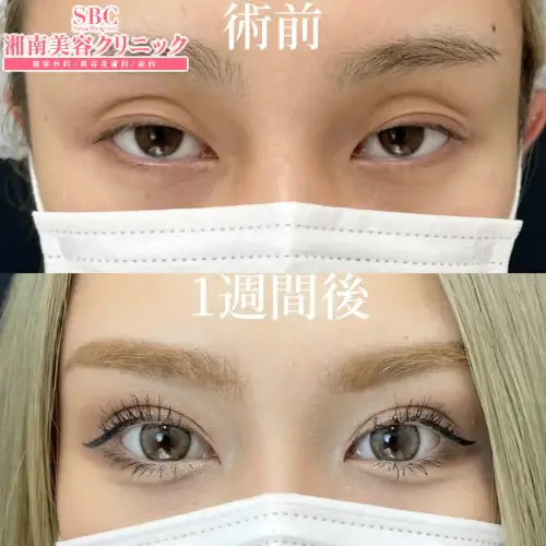 湘南美容クリニック 新宿本院の症例写真2