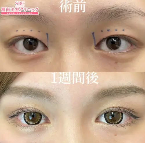 湘南美容クリニック 本院の症例写真3