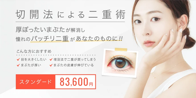TCBの切開二重